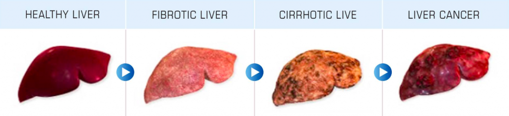 यकृत: Liver in Hindi